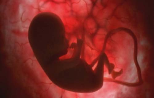 胎儿子宫内发育清晰图片秀